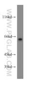 Leucine Rich Glioma Inactivated 1 antibody, 12483-1-AP, Proteintech Group, Western Blot image 