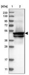 Keratin 24 antibody, NBP1-83665, Novus Biologicals, Western Blot image 