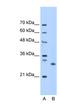 Homologous-pairing protein 2 homolog antibody, NBP1-79237, Novus Biologicals, Western Blot image 