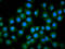 Intraflagellar Transport 172 antibody, LS-C680638, Lifespan Biosciences, Immunofluorescence image 