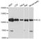 Helicase POLQ-like antibody, STJ114535, St John