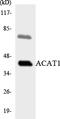 Sterol O-Acyltransferase 1 antibody, LS-C200074, Lifespan Biosciences, Western Blot image 