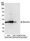 STOM antibody, A304-425A, Bethyl Labs, Western Blot image 