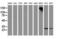 Pyrroline-5-Carboxylate Reductase 3 antibody, M32428-2, Boster Biological Technology, Western Blot image 