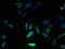 Growth Hormone Inducible Transmembrane Protein antibody, orb355035, Biorbyt, Immunocytochemistry image 