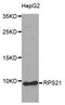Ribosomal Protein S21 antibody, abx127038, Abbexa, Western Blot image 