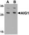 Androgen Induced 1 antibody, TA319923, Origene, Western Blot image 
