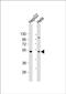 ZFP2 Zinc Finger Protein antibody, PA5-49508, Invitrogen Antibodies, Western Blot image 