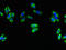 SPG11 Vesicle Trafficking Associated, Spatacsin antibody, orb35546, Biorbyt, Immunofluorescence image 