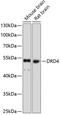 Dopamine Receptor D4 antibody, 14-953, ProSci, Western Blot image 