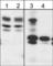 WASP Family Member 2 antibody, WP1821, ECM Biosciences, Western Blot image 