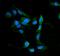 Major Vault Protein antibody, FNab05449, FineTest, Immunofluorescence image 