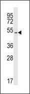 Mitogen-Activated Protein Kinase 10 antibody, PA5-14049, Invitrogen Antibodies, Western Blot image 