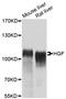 Hepatocyte Growth Factor antibody, STJ23940, St John