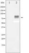 Lipase E, Hormone Sensitive Type antibody, TA325624, Origene, Western Blot image 