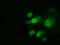 Protein Phosphatase Methylesterase 1 antibody, TA500822, Origene, Immunofluorescence image 