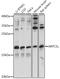 Actin Related Protein 2/3 Complex Subunit 5 Like antibody, A13624, Boster Biological Technology, Western Blot image 
