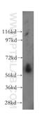 CDC73 antibody, 12310-1-AP, Proteintech Group, Western Blot image 