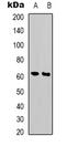 PHD Finger Protein 1 antibody, LS-C368644, Lifespan Biosciences, Western Blot image 
