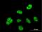 BUD23 RRNA Methyltransferase And Ribosome Maturation Factor antibody, H00114049-B01P, Novus Biologicals, Immunofluorescence image 