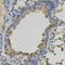 Psat antibody, 15-383, ProSci, Immunohistochemistry paraffin image 