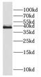 Family With Sequence Similarity 118 Member B antibody, FNab02958, FineTest, Western Blot image 