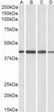 ArfGAP With Dual PH Domains 1 antibody, orb18951, Biorbyt, Western Blot image 