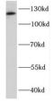 DEAD-Box Helicase 46 antibody, FNab02310, FineTest, Western Blot image 