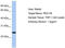 Peroxisomal Biogenesis Factor 11 Beta antibody, TA339382, Origene, Western Blot image 