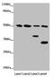 Natural Killer Cell Cytotoxicity Receptor 3 Ligand 1 antibody, LS-C678776, Lifespan Biosciences, Western Blot image 