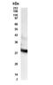 Retinol Dehydrogenase 11 antibody, NBP2-27584, Novus Biologicals, Western Blot image 