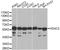 Histone Deacetylase 2 antibody, A2084, ABclonal Technology, Western Blot image 