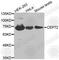 Centrosomal Protein 72 antibody, A3457, ABclonal Technology, Western Blot image 