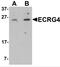 ECRG4 Augurin Precursor antibody, NBP2-81925, Novus Biologicals, Western Blot image 