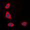 ERBB2 antibody, orb315778, Biorbyt, Immunofluorescence image 