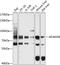 Disintegrin and metalloproteinase domain-containing protein 28 antibody, 23-875, ProSci, Western Blot image 