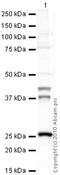 Cathepsin K antibody, ab37259, Abcam, Western Blot image 