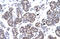 X-Ray Repair Cross Complementing 5 antibody, ARP34121_T100, Aviva Systems Biology, Immunohistochemistry paraffin image 