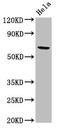 Acyl-CoA Dehydrogenase Very Long Chain antibody, CSB-PA001129LA01HU, Cusabio, Western Blot image 