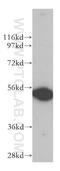 DEAD (Asp-Glu-Ala-Asp) box polypeptide 6 antibody, 14632-1-AP, Proteintech Group, Western Blot image 