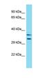 Putative protein FAM90A12 antibody, orb326977, Biorbyt, Western Blot image 