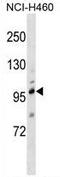 Transient Receptor Potential Cation Channel Subfamily C Member 1 antibody, AP54359PU-N, Origene, Western Blot image 