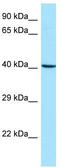 Actin Related Protein 2/3 Complex Subunit 1B antibody, TA338143, Origene, Western Blot image 