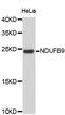 NADH:Ubiquinone Oxidoreductase Subunit B9 antibody, abx002916, Abbexa, Western Blot image 