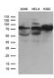 Polypeptide N-Acetylgalactosaminyltransferase 10 antibody, LS-C794912, Lifespan Biosciences, Western Blot image 