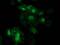 Eukaryotic Translation Initiation Factor 4E Family Member 2 antibody, MA5-25412, Invitrogen Antibodies, Immunocytochemistry image 