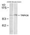 Short transient receptor potential channel 6 antibody, AP08080PU-S, Origene, Western Blot image 