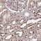 LAS1 Like, Ribosome Biogenesis Factor antibody, NBP2-38921, Novus Biologicals, Immunohistochemistry paraffin image 
