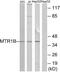 Melatonin Receptor 1B antibody, A30844, Boster Biological Technology, Western Blot image 