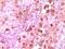 S100 Calcium Binding Protein A6 antibody, 32-124, ProSci, Western Blot image 
